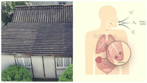 L'asbestose peut être provoquée par l'exposition à l'amiante dans les vieilles maisons