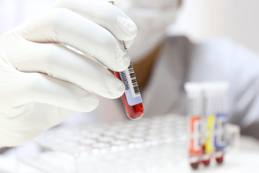 Un échantillon de sang pour analyse de monocytes