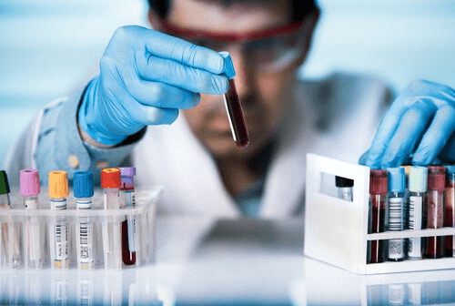 Un homme fait des tests en laboratoire sur le lien entre coronavirus et VIH