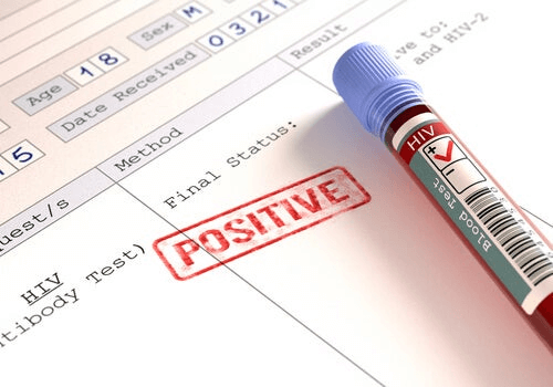 Les personnes atteintes du VIH sont-elles plus exposées au coronavirus ?