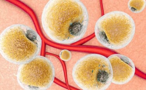 Une illustration de l'inflammation cellulaire