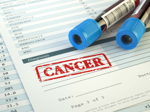 Le développement d'un cancer et les analyses