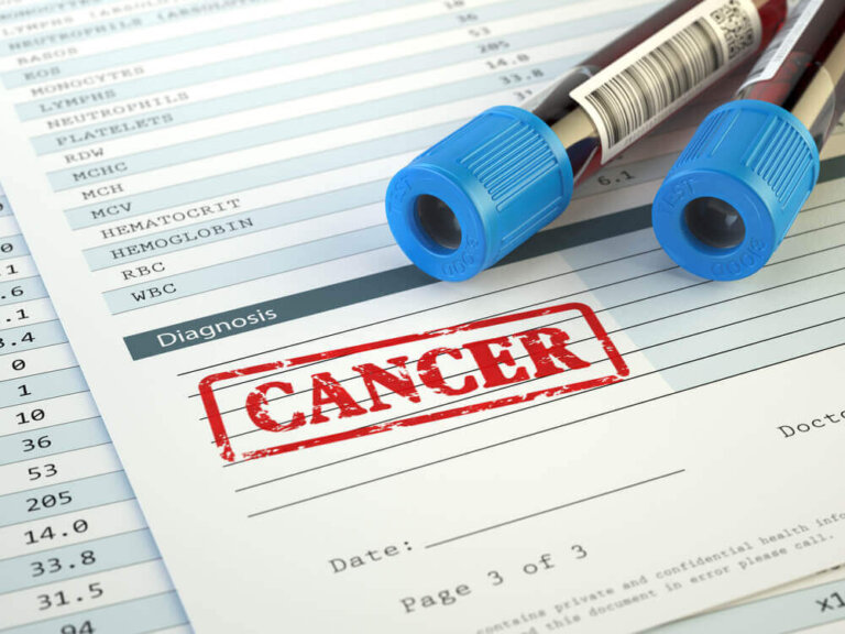 L'étude génomique Pan-Cancer : détecter les tumeurs avant qu'elles n'apparaissent