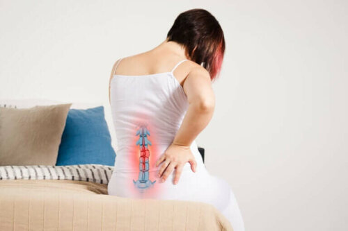 Une femme souffrant de radiculopathie