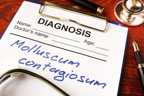 Le molluscum contagiosum, qu'est-ce que c'est ?