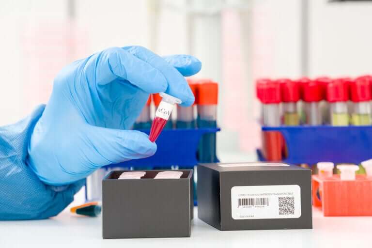 Détection du coronavirus : qu'est-ce qu'une PCR ?