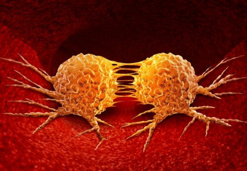 Des cellules cancéreuses