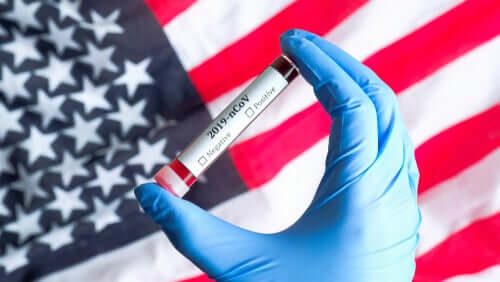Les États-Unis commencent à tester le vaccin contre le COVID-19 chez les êtres humains
