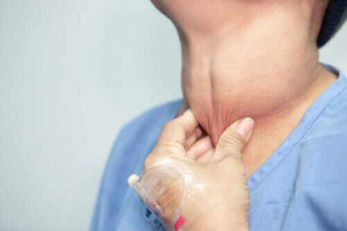 Une personne souffrant d'un cancer de la thyroïde