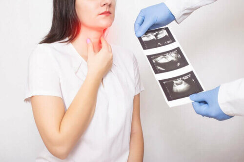 Qu'est-ce que le cancer de la thyroïde ?