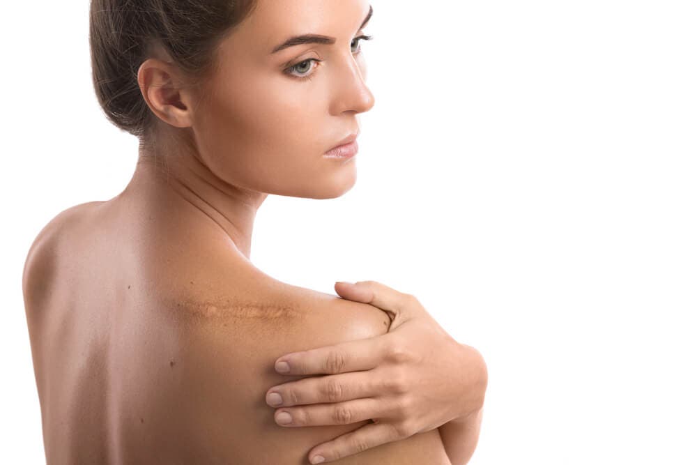 L'huile essentielle de citronnelle et ses bienfaits pour la peau