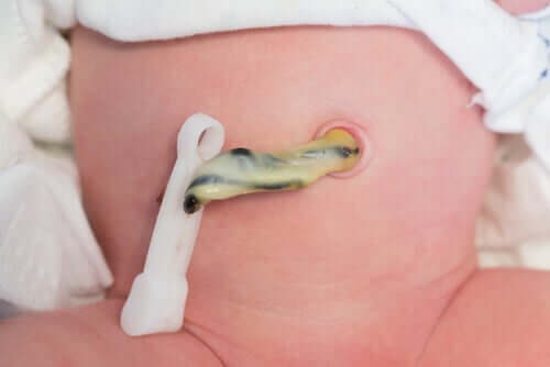 La découpe du cordon ombilical d'un nouveau-né