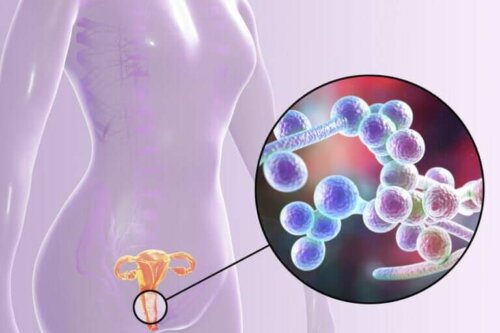 Connaissez-vous le test de détection de la candidose ?
