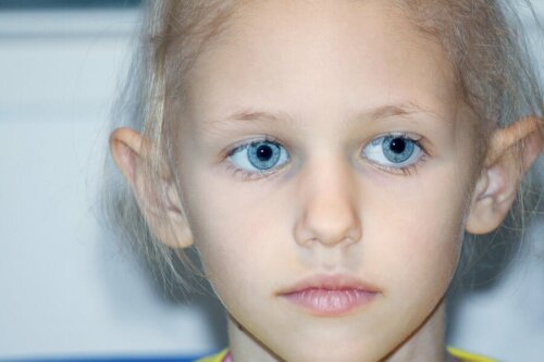 Une jeune fille atteinte de rétinoblastome