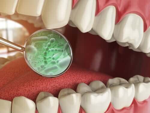 Quelles sont les bactéries de la bouche ?