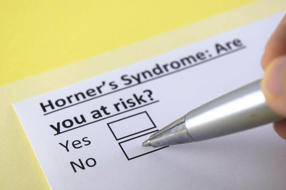 ¿Qué es el síndrome de Claude Bernard-Horner? TodoSALUD