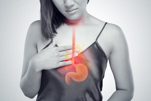 Les brûlures d'estomac sont un des symptômes les plus courants de la myomatose utérine géante