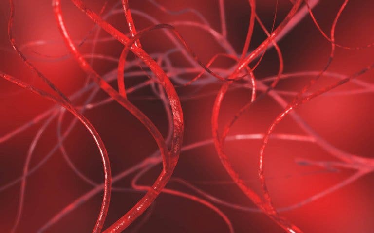 Comment traiter la varicocèle ?