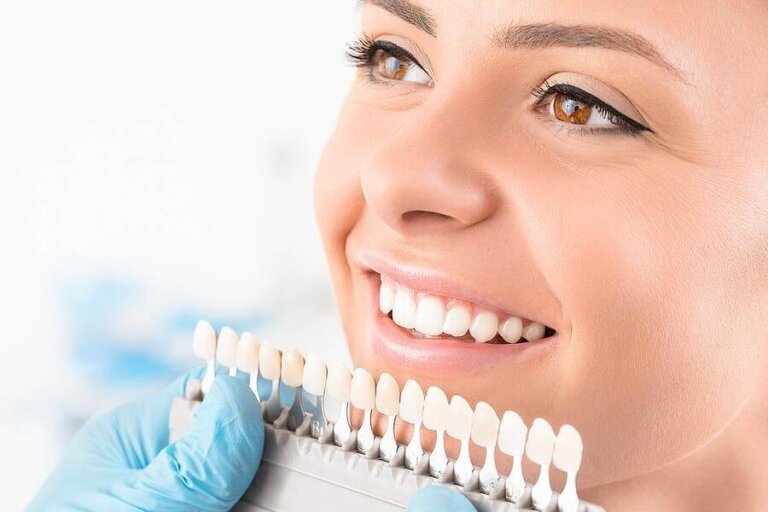 Blanchiment dentaire : qu'est-ce que c'est et quels sont les différents types ?