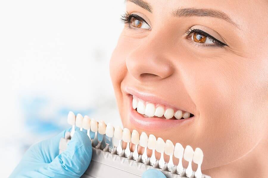 Blanchiment dentaire : qu’est-ce que c’est et quels sont les différents types ?
