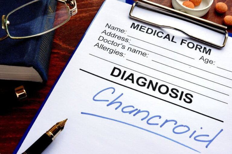 Chancre mou : symptômes et traitement
