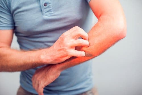 Un homme qui se gratte le bras à cause de la tungose