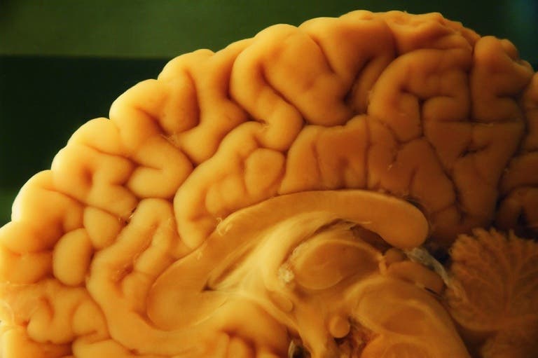 L'autopsie neuropathologique dans le cerveau