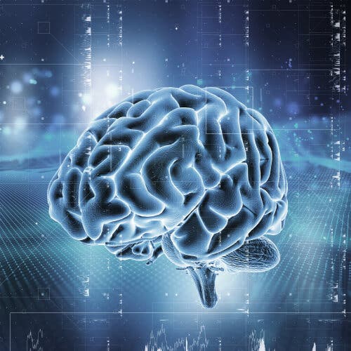 Un cerveau touché par une tumeur cérébrale