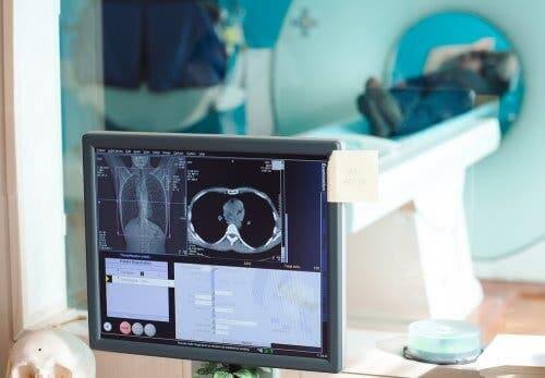 Epanchement péricardique et radiographie thoracique