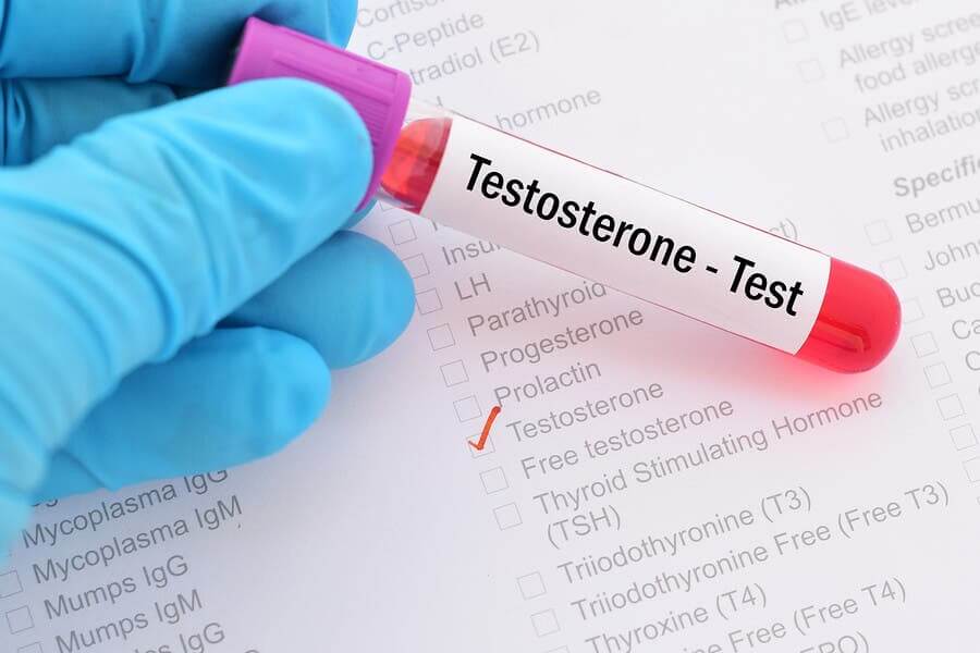 Qu’est-ce que le syndrome du déficit en testostérone ?