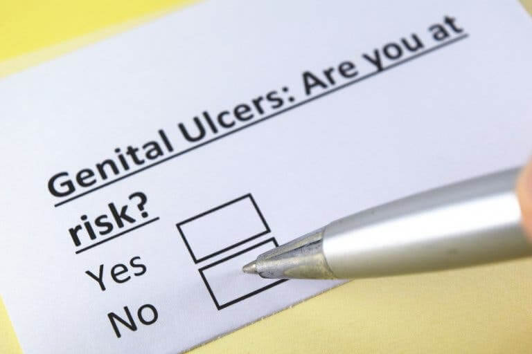 Les ulcères génitaux et le chancre mou