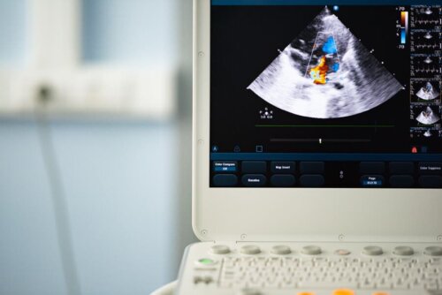 Valvule aortique bicuspide : diagnostic et traitement
