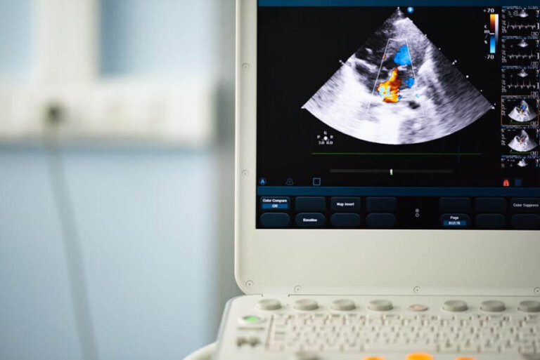 Valvule aortique bicuspide : diagnostic et traitement