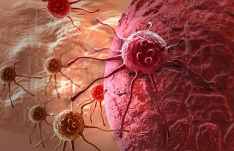 Le régime alcalin et le cancer