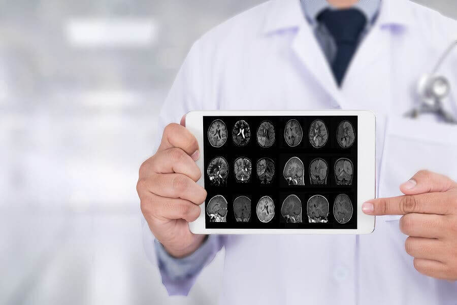 ¿Qué significa vivir con una atrofia multisistémica?
-Todosalud TodoSALUD