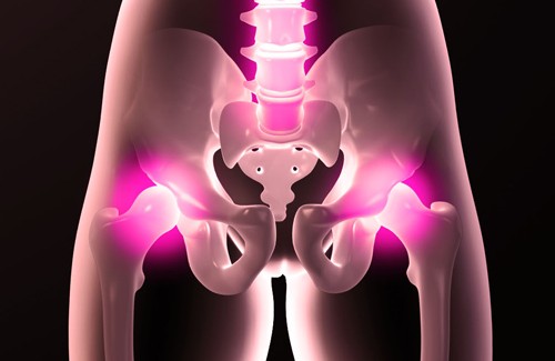 Les douleurs de la hanche