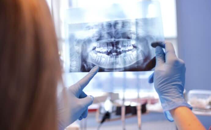 Le développement d'une gangrène diabétique dans la bouche