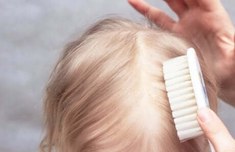 Croûte sur une tête de petite fille.