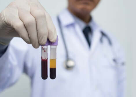 Un médecin avec deux pipettes de sang et de plasma. 