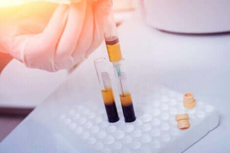 Pipettes de sang et de plasma.