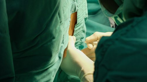 Céphalée post-ponction lombaire, un mal de tête causé par la ponction lombaire