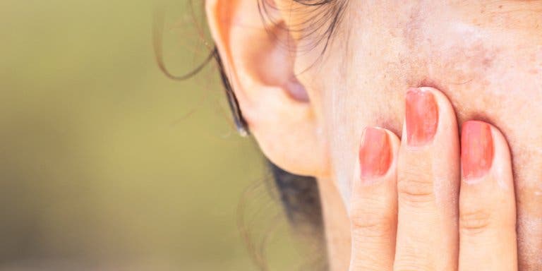 Des conseils de maquillage pour corriger les taches dues au mélasma
