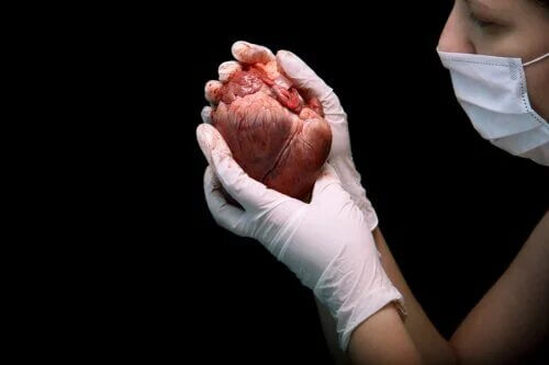 En quoi consiste la transplantation cardiaque ?