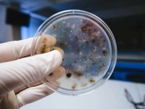 Les germes sont étudiées en laboratoire.