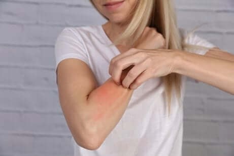 La photosensibilisation provoque des allergies cutanées.