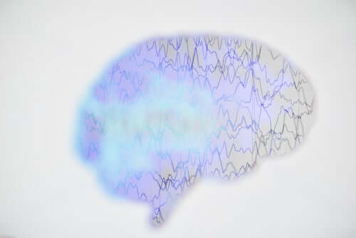Que se passe-t-il dans le cerveau lors d'une crise d'épilepsie ?