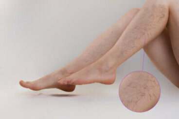 Exercices pour lutter contre les varices