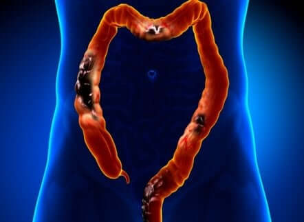 Illustration de l'intestin.