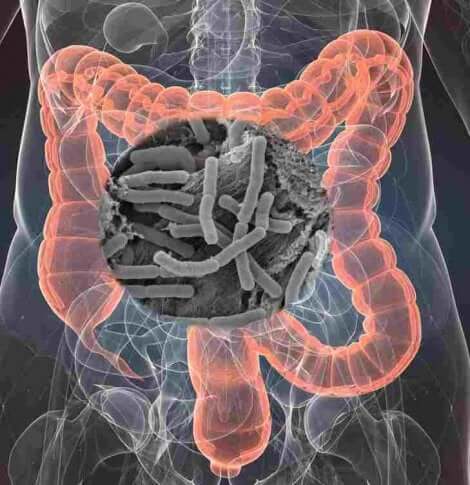 Les maladies chroniques peuvent s'attaquer au microbiote.