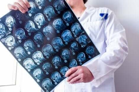 Un médecin qui examine les méninges via une radiologie.